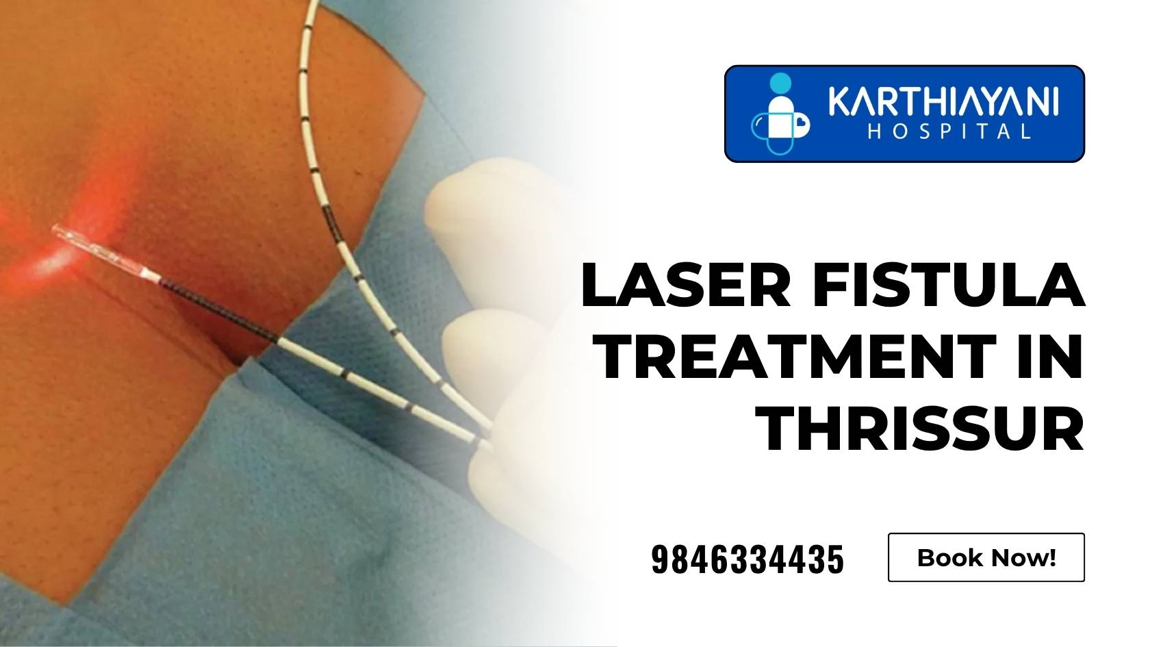 Laser fistula treatment at Karthiayani Hospital Thrissur